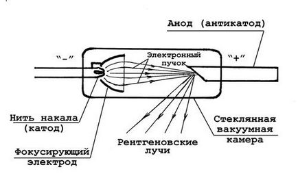 Шкідливі наслідки рентгенівського опромінення