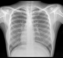 Știți cât de des este posibil să faceți o radiografie și este periculoasă pentru o persoană