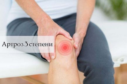 Artroza de gradul trei al semnelor și tratamentului articulației genunchiului