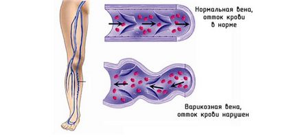 Стегновий нерв, його анатомія, функції та захворювання