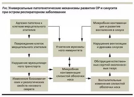 Ce este sinuzita - o clasificare a metodelor sinusite de diagnostic și tratament