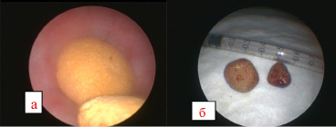 Cystoscopia az urolithiasis kutyák és macskák - International Student Scientific Bulletin