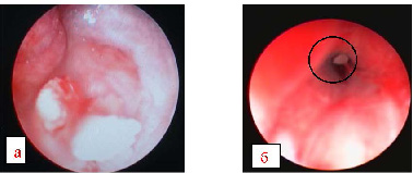 Cystoscopia az urolithiasis kutyák és macskák - International Student Scientific Bulletin