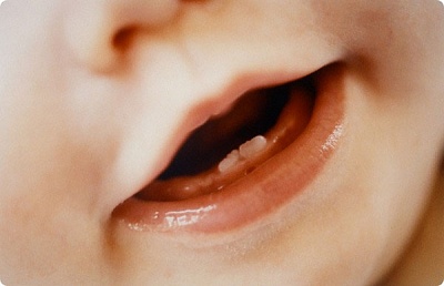 Дитяча стоматологія - корисні статті на kupibonus, а також купони, знижки на послуги в москві -
