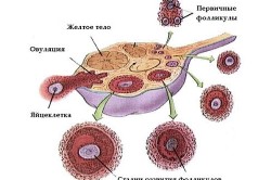 Eco după îndepărtarea tuburilor uterine