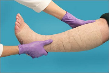 Varicoză ca banda elastică picioare picioare - Dimensiunea bandajelor elastice în varicoza