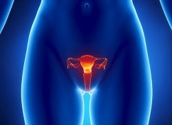 Fibromiomul uterului