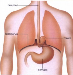 Hiatus hernia tünetei, diéta, kezelése népi jogorvoslat