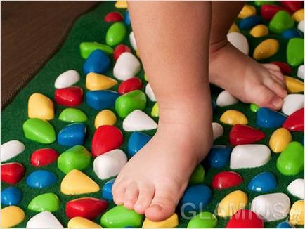 Cum să tratăți picioarele plate la copii - picioare plate la copii