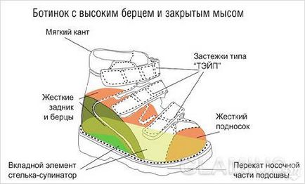 Як боротися з плоскостопістю у дітей - плоскостопість у дитини