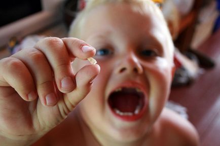 Ce dinti se schimba la copii de la lactate la permanente