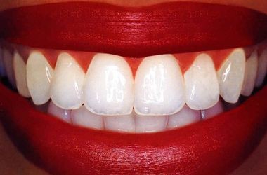 Як проблеми з зубами можуть нашкодити решті організму - медицина 2