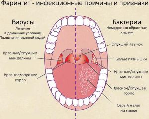 Як вилікувати кашель у дитини що робити, щоб швидко його позбутися