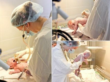 Császármetszés a saját szemével (35 fotó) (lehet) Császármetszés a saját szemével (35 fotó)