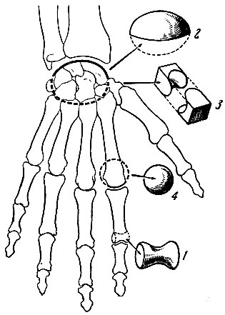 Класифікація з'єднань кісток 1970 гусев а