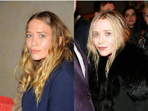 Mary Kate olsen înainte și după fotografie din plastic - femeie