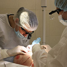 Metoda fue este o metodă fără probleme de transplant de păr, centrul de transplant și tratamentul părului