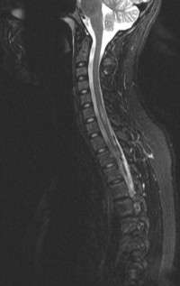 MRI на гръбначния стълб и цената, където можете да направите, ядрено-магнитен резонанс на гръбначния стълб в Санкт Петербург