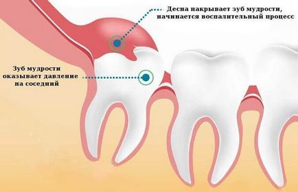 Новітні методи в лікування зубів, пломбування зубів, усунення болю в зубах