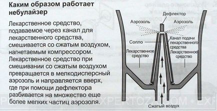 Огляд компресорних небулайзера (інгалятора) omron ne-c24, expertoza