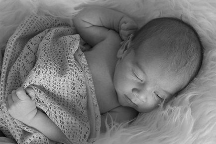 Попрілості у новонароджених - чим лікувати, фото і відео