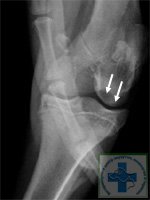 Osteochondropatia articulației genunchiului la câini