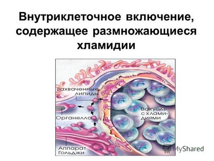 Prezentarea pe tema chlamydia urogenitală a chlamydia urogenitală este o infecție