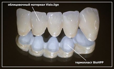 Protézisek Moldova - a legújabb technológiát clasicdent