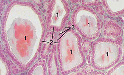 Щитовидна залоза 2