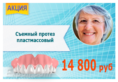 Зліпки на зуби в стоматології вартість недорого