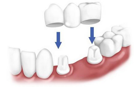 Dental abba, recenzii electrostatice pentru pacienți