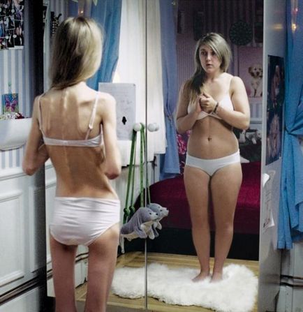 Consecințele aspre ale anorexiei (35 de fotografii), pulsul