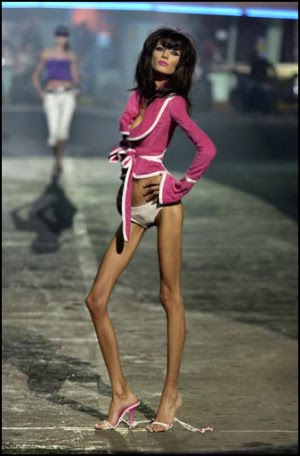 Szörnyű következményeit anorexia (35 fotó), pulson