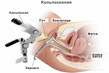 Рисуване, шевове, болки болки във вагината - причини, лечение