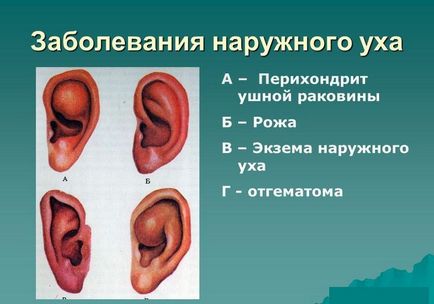 У дитини почервоніло вухо що робити, якщо опухла мочка, зовні або всередині раковини