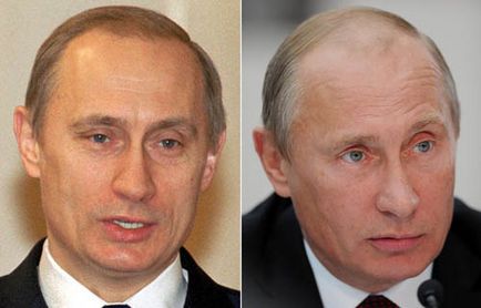 Vlagyimir Putyin - fotók előtt és után plasztikai sebészet lehetséges