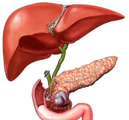 Másodlagos pancreatitis és annak kezelése (másodlagos) Másodlagos pancreatitis és annak kezelése