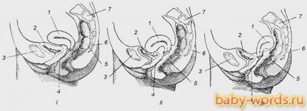 Îndoirea uterului posterior (îndoirea colului uterin), îndoirea uterului fotografiei, îndoirea uterului cauzei, lumea copilului