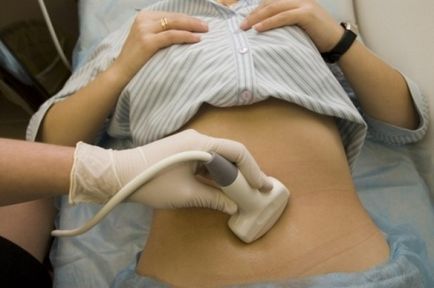 Obstetrica si ginecologie - sarcina ectopica