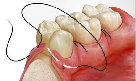 Що робити якщо хитаються зуби, стоматологія