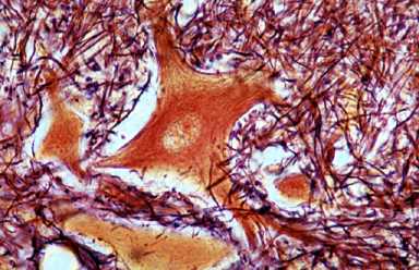 Ce este un neuron, activitatea sistemului nervos