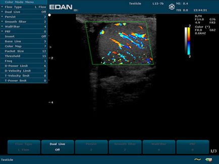 Dus 60 edan - aparat ultrasunete portabil alb-negru cu doppler cu impulsuri