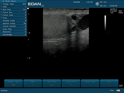 Dus 60 edan - aparat ultrasunete portabil alb-negru cu doppler cu impulsuri