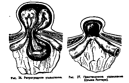 Етіологія і патогенез