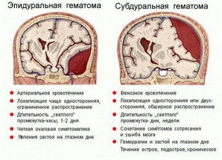 Cefaleea după leziuni cerebrale traumatice (chmt)