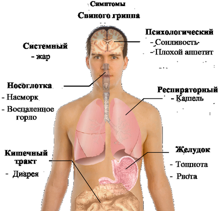 Influenza, közös gbuz - Svobodnenskaya Hospital