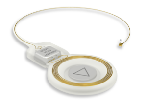 A középfül implantátum, med-El rus (Élénk SoundBridge tag) Középfül implantátum, med-el hun