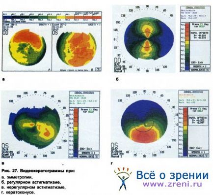 Investigarea formei corneei