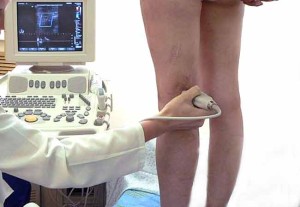 Măsurarea picioarelor pacientului pentru selectarea tricotajului de compresie (lenjerie de compresie), clinică