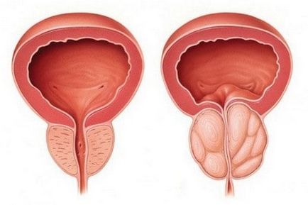 Cum de a restabili repede sperma rezervă toate metodele posibile